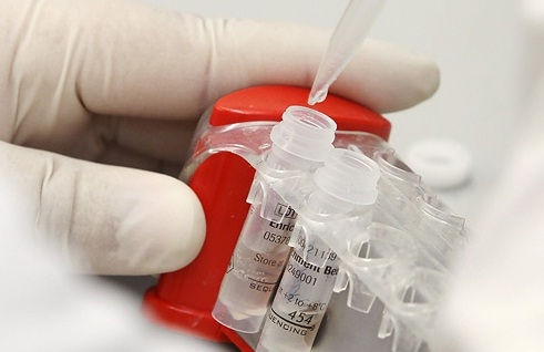 50% POPUSTA NA KOMPLETAN LABORATORIJSKI PREGLED KRVI I URINA U POLIKLINICI &bdquo;SVEČNJA...