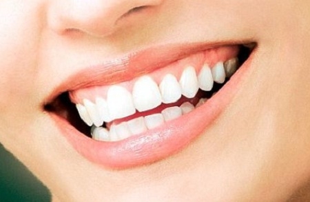 Tretman izbjeljivanja zubi u Stomatolo&scaron;koj poliklinici DENTA OPTIC