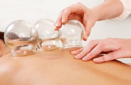 Cupping anticelulitna masaža ili cupping masaža vakuumom za leđa i vrat