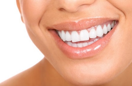 Izbjeljivanje zubi dijamantnim Smile tretmanima u Studiju ESTETIC